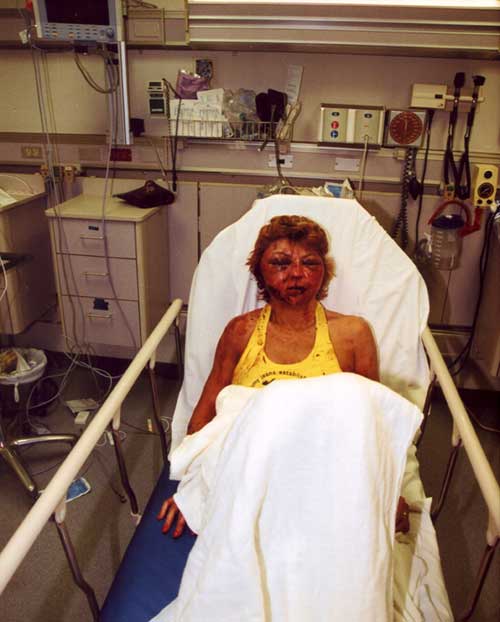This lady was beaten so badly by her husband that her best friend could not find her in the Emergency Room